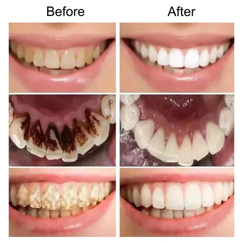 V34 Teeth Whitening Mousse Toothpaste